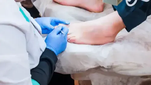 Ingrown Toenail Surgery Cost in India | Price Guide